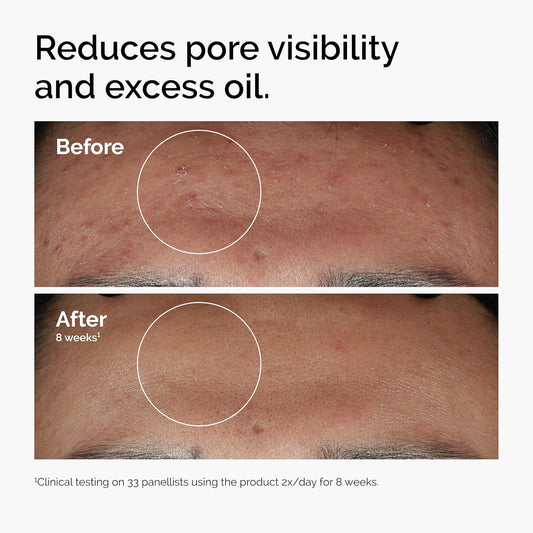 Glow-Boosting Skin Serum